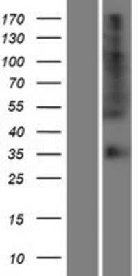 Western Blot: OR56B4 Overexpression Lysate [NBP2-08914]