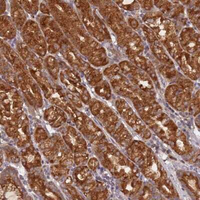 Immunohistochemistry: OR5A2 Antibody [NBP2-48867]