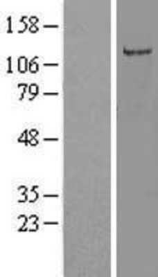 Western Blot: OR5AC2 Overexpression Lysate [NBP2-05806]