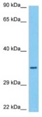 Western Blot: OR5AP2 Antibody [NBP3-10250]