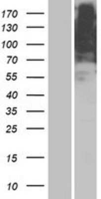 Western Blot: OR5AR1 Overexpression Lysate [NBP2-08903]