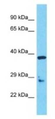 Western Blot: OR5AU1 Antibody [NBP3-09850]