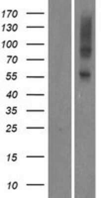 Western Blot: OR5AU1 Overexpression Lysate [NBP2-08904]