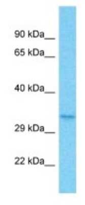 Western Blot: OR5B12 Antibody [NBP3-09797]