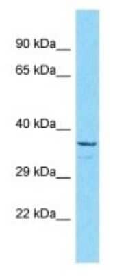 Western Blot: OR5B3 Antibody [NBP3-09798]