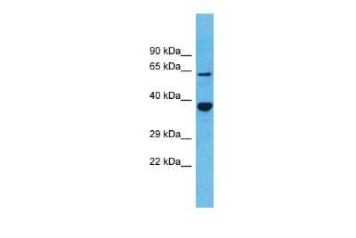 Western Blot: OR5D13 Antibody [NBP3-09800]