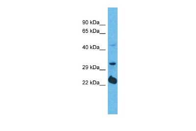 Western Blot: OR5D14 Antibody [NBP3-09801]