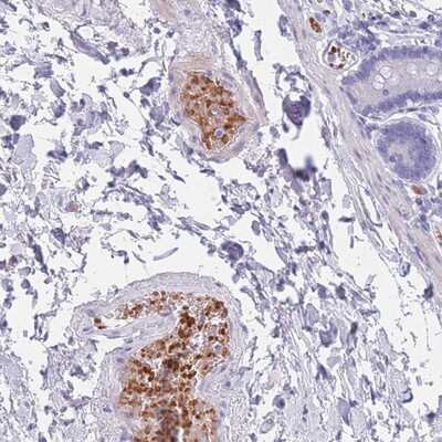 Immunohistochemistry-Paraffin: OR5D16 Antibody [NBP2-13705]