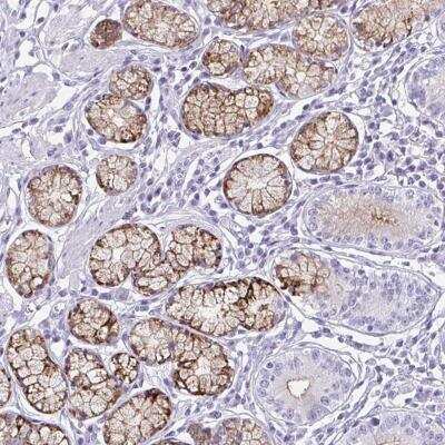 Immunohistochemistry-Paraffin: OR5F1 Antibody [NBP2-32453]