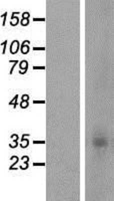 Western Blot: OR5F1 Overexpression Lysate [NBP2-07965]