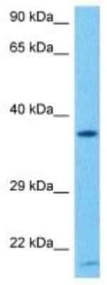 Western Blot: OR5H6 Antibody [NBP3-10252]