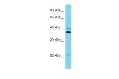 Western Blot: OR5I1 Antibody [NBP3-09616]