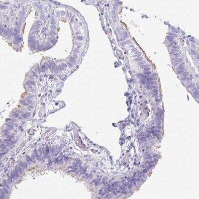 Immunohistochemistry-Paraffin: OR5J2 Antibody [NBP2-31771]