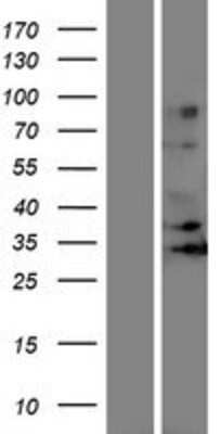 Western Blot: OR5J2 Overexpression Lysate [NBP2-08839]