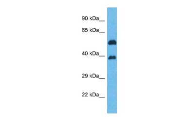 Western Blot: OR5K2 Antibody [NBP3-09805]