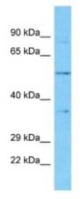 Western Blot: OR5K4 Antibody [NBP3-09807]