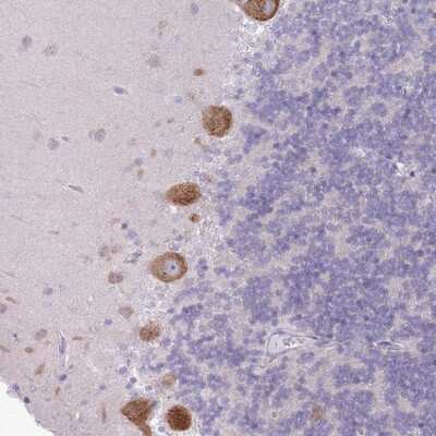 Immunohistochemistry-Paraffin: OR5L1 Antibody [NBP2-13706]