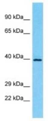 Western Blot: OR5M10 Antibody [NBP3-09817]