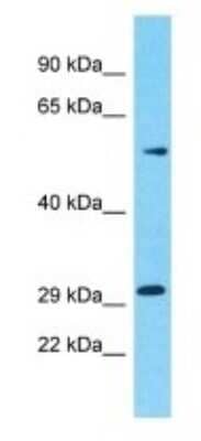 Western Blot: OR5M10 Antibody [NBP3-09819]