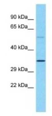 Western Blot: OR5M9 Antibody [NBP3-09818]