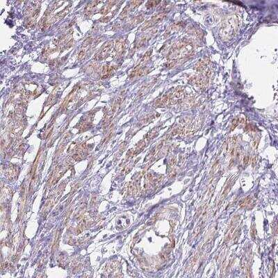 Immunohistochemistry-Paraffin: OR5P3 Antibody [NBP2-32566]