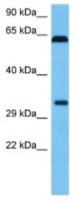 Western Blot: OR5P3 Antibody [NBP3-10236]