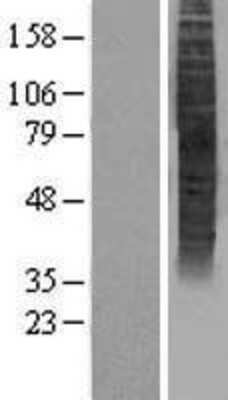 Western Blot: OR5P3 Overexpression Lysate [NBP2-04431]