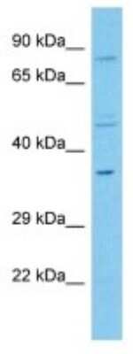 Western Blot: OR5R1 Antibody [NBP3-10266]