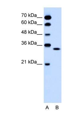 Western Blot: OR5T2 Antibody [NBP1-59622]