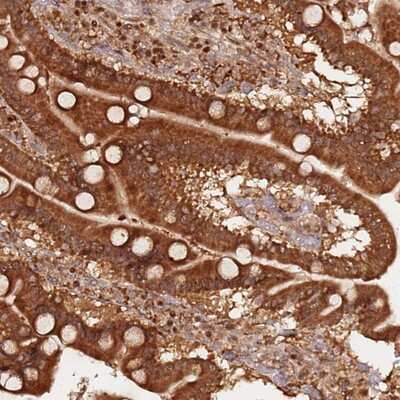 Immunohistochemistry-Paraffin: OR5V1 Antibody [NBP2-13709]