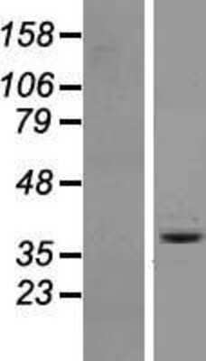 Western Blot: OR6A2 Overexpression Lysate [NBL1-13967]