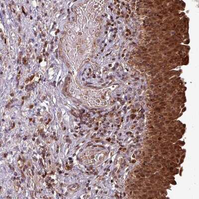 Immunohistochemistry-Paraffin: OR6B1 Antibody [NBP2-13710]