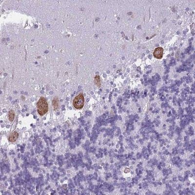 Immunohistochemistry-Paraffin: OR6B2 Antibody [NBP2-13711]