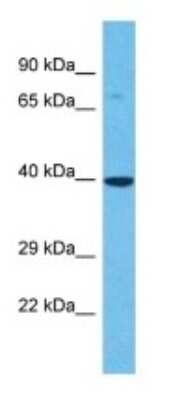 Western Blot: OR6B3 Antibody [NBP3-09822]