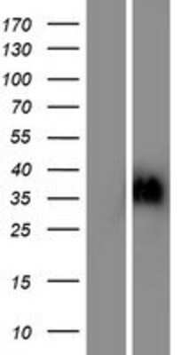 Western Blot: OR6C2 Overexpression Lysate [NBP2-05805]