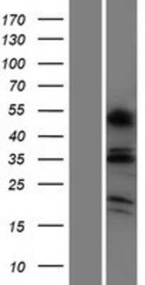 Western Blot: OR6C4 Overexpression Lysate [NBP2-08840]