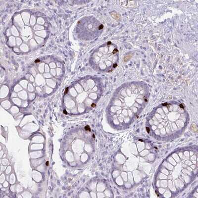 Immunohistochemistry-Paraffin: OR6C6 Antibody [NBP2-13712]