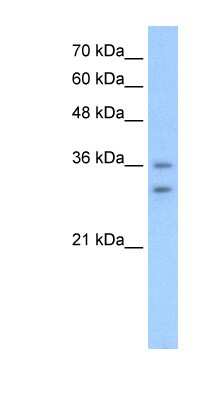 Western Blot: OR6C70 Antibody [NBP1-59363]