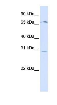 Western Blot: OR6C75 Antibody [NBP1-59362]