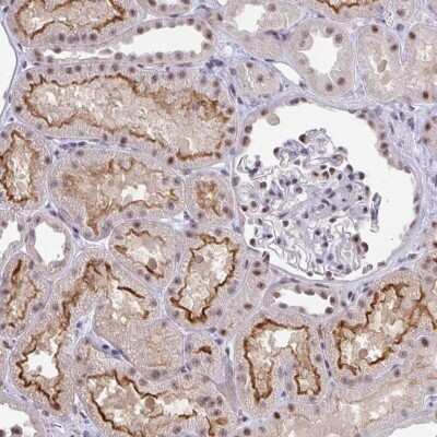 Immunohistochemistry: OR6K3 Antibody [NBP2-31618]