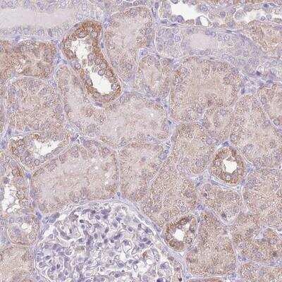 Immunohistochemistry-Paraffin: OR6M1 Antibody [NBP2-13713]