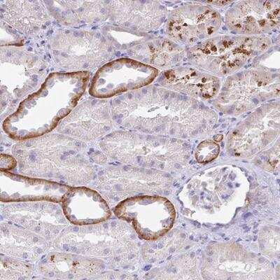 Immunohistochemistry-Paraffin: OR6N2 Antibody [NBP2-31645]