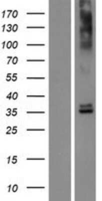 Western Blot: OR6N2 Overexpression Lysate [NBP2-08882]