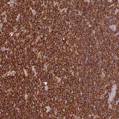 Immunohistochemistry-Paraffin: OR6P1 Antibody [NBP1-92231]