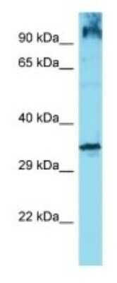 Western Blot: OR6Q1 Antibody [NBP3-09832]