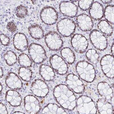 Immunohistochemistry-Paraffin: OR6T1 Antibody [NBP2-32571]