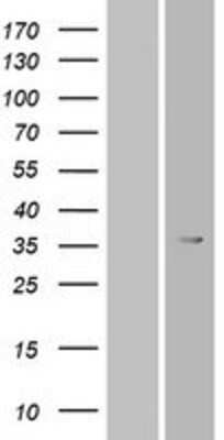 Western Blot: OR6T1 Overexpression Lysate [NBP2-08915]