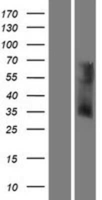 Western Blot: OR6V1 Overexpression Lysate [NBP2-08956]