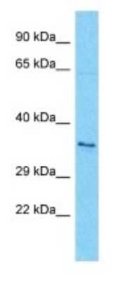 Western Blot: OR7A17 Antibody [NBP3-09812]