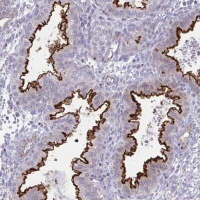 Immunohistochemistry: OR7A5 Antibody [NBP2-31568]